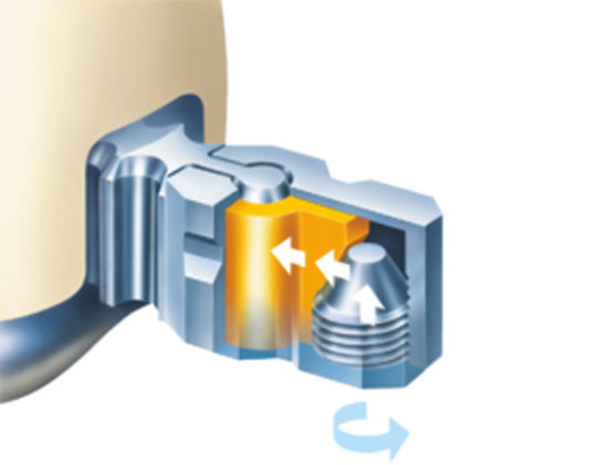 ap_sv_geschiebe_gr-Kopie